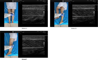 Suitable ultrasound screening method for older adults with disability to identify low muscle mass